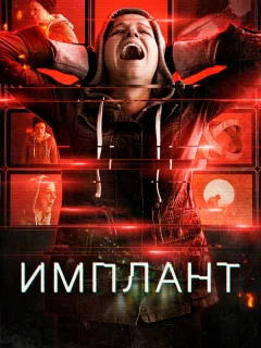 Имплант